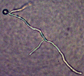 Amanita thiersii spore germinating - courtesy Pringle Lab and Benjamin Wolfe